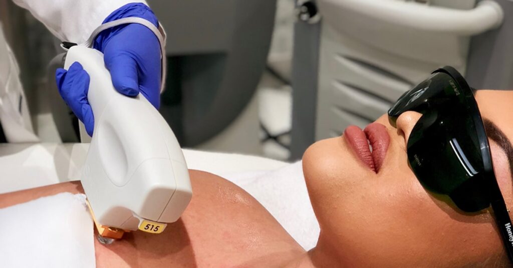 تفاوت فناوری IPL با لیزر