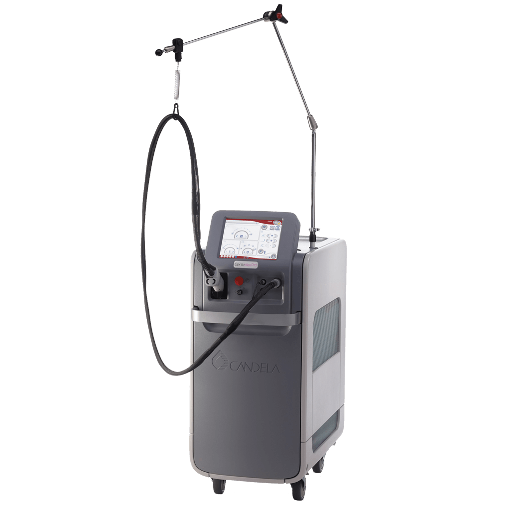 لیزر الکس کندلا