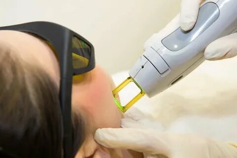 لیزر رادو پلاس