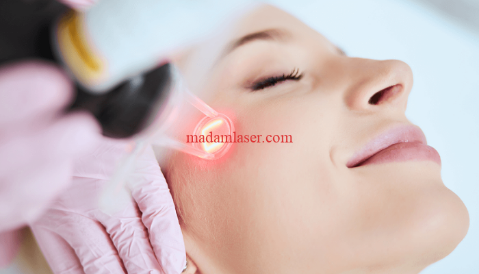 درمان اگزما با لیزر چگونه انجام می شود؟