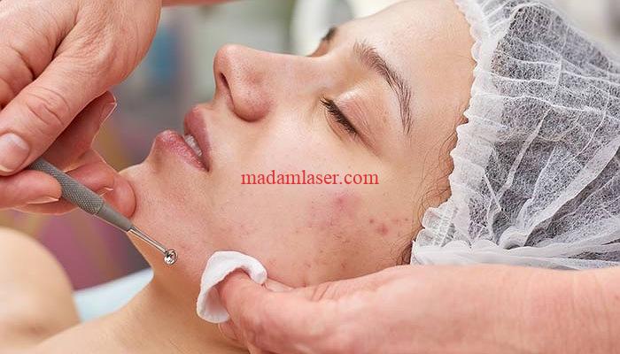 مفهوم فیشیال و فایده های آن برای پوست صورت