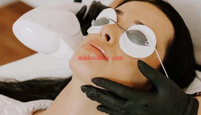 نکاتی که قبل از لیزر موهای زائد صورت باید دانست